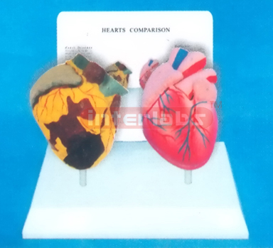 DESK-TYPE, HEART MODEL FOR COMPARISION DEMONSTRATING HEALTH MAN THAN SMOKING MAN WITH DESCRIPTION PLATE